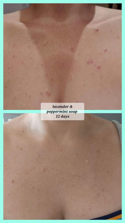 Mint & Eucalyptus Soap 100g – Invigorating & Fresh as Morning Air