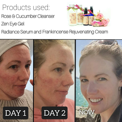 Zen Sandalwood Eye Gel 20ml - Hydrate, Brighten & Refresh – Naturally